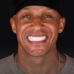 Snap-On Dentures Icon: Icon representing snap-on dentures